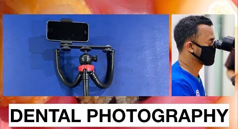 Dental-photography-lighting-for-mobile-phone-tutorial