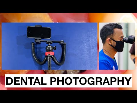 Dental-photography-lighting-for-mobile-phone-tutorial