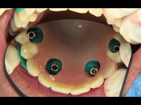 treatment-concept-clinical-case-1
