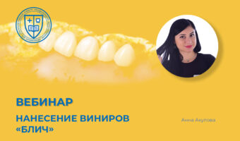 «Нанесение виниров «блич»