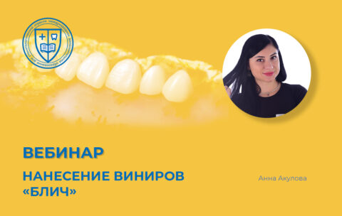 «Нанесение виниров «блич»
