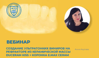 Создание ультратонких виниров на рефракторе из керамической массы Duceram Kiss + коронка e.max Ceram на основе диоксида циркония на имплантате