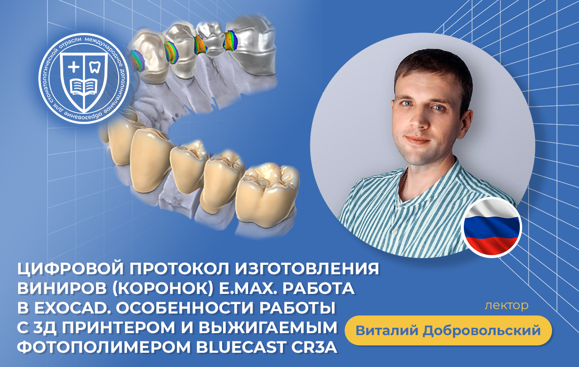 «Цифровой протокол изготовления виниров (коронок) E.max. Работа в Exocad. Особенности работы с 3Д принтером и выжигаемым фотополимером Bluecast CR3A»