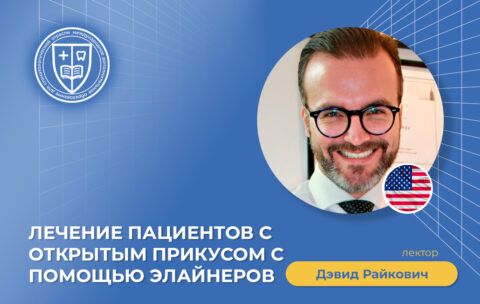 Лечение пациентов с открытым прикусом с помощью элайнеров