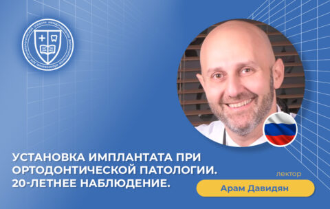 Установка имплантата при ортодонтической патологии_