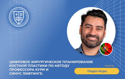 Цифровое хирургическое планирование костной пластики по методу профессора Кури и синус лифтинге_
